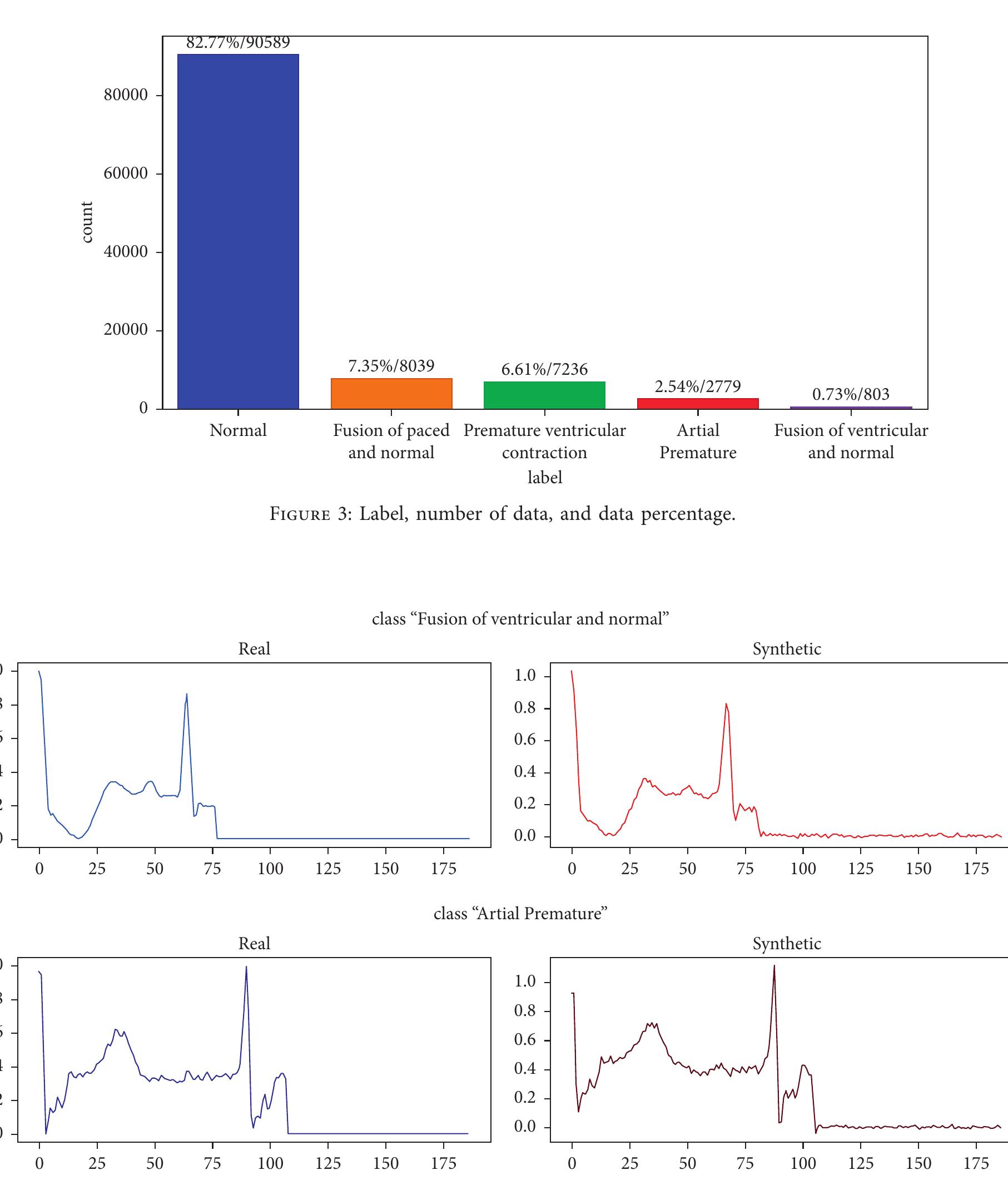 Figure 4 - from Classification of Arrhythmia in Heartbeat