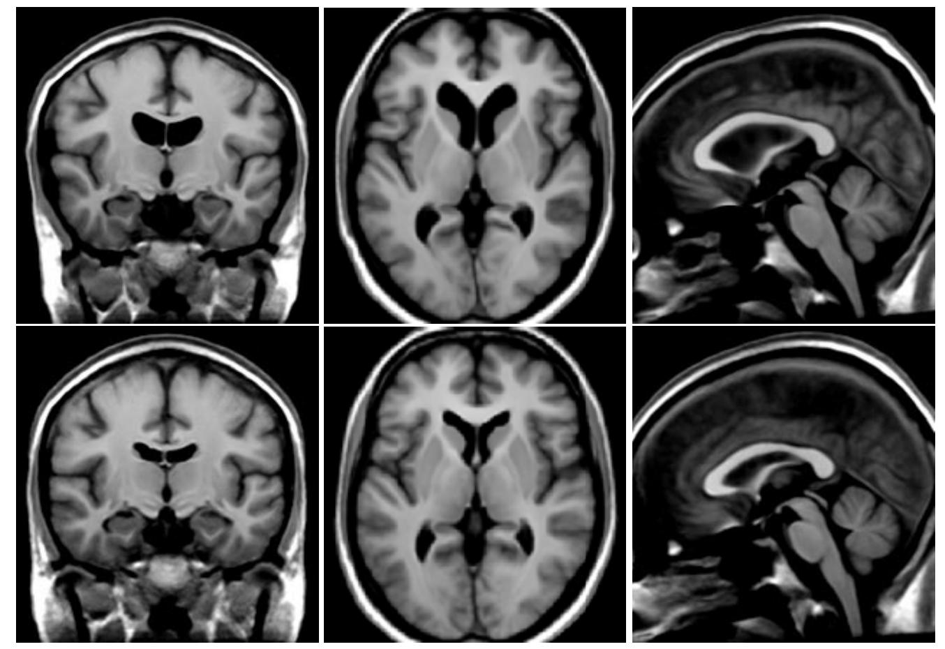 The top row shows a coronal, axial and sagittal view of the