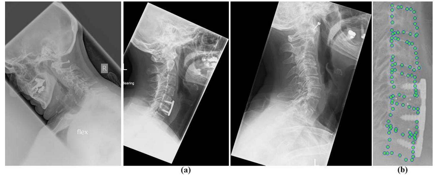 Figure 1 - from Global Localization and Orientation of the