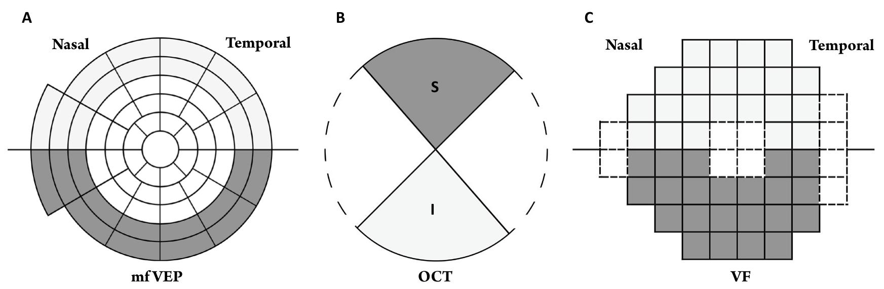(PDF) Multifocal visual evoked potential for evaluation of open-angle ...
