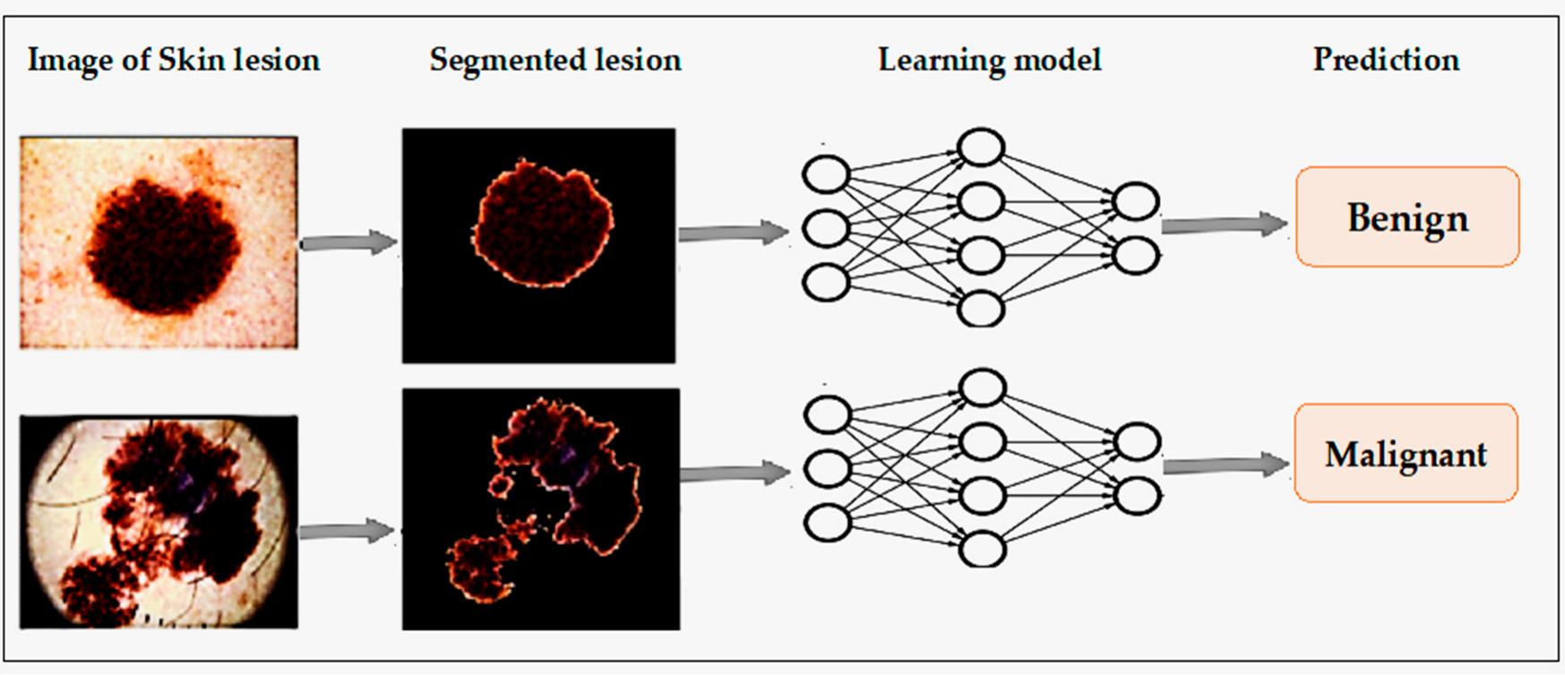 (PDF) Skin Cancer Detection: A Review Using Deep Learning Techniques
