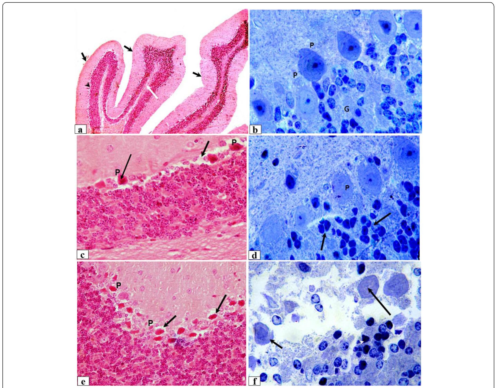 A-f light micrograph of sections of the cerebellar cortex of