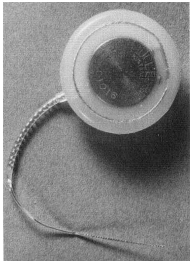Figure 1 - from The University of Melbourn/Nucleus Cochlear