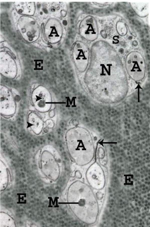 An electronmicrograph of a transverse section in the sciatic