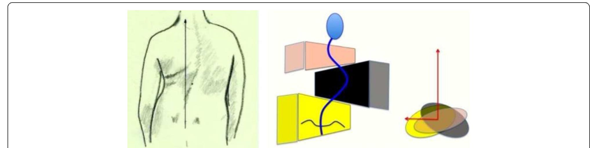 Line Rigo Figure 17 - from Brace technology thematic series: the 3D