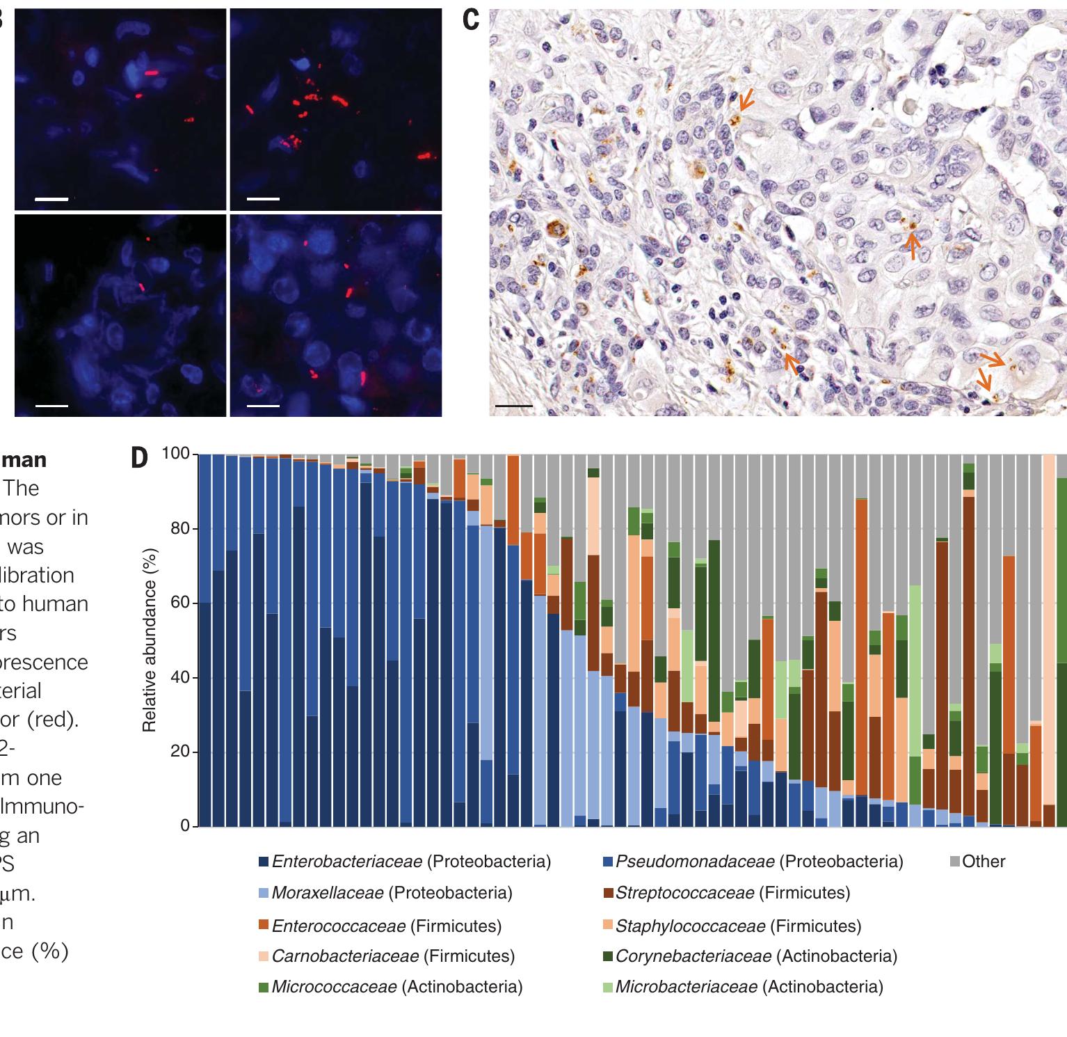Figure 1 - from Potential role of intratumor bacteria in