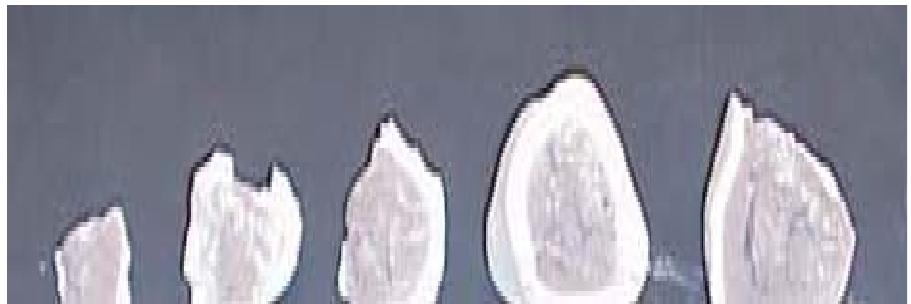 Figure 1.6: Cross section of unburned lime particles [9]. 