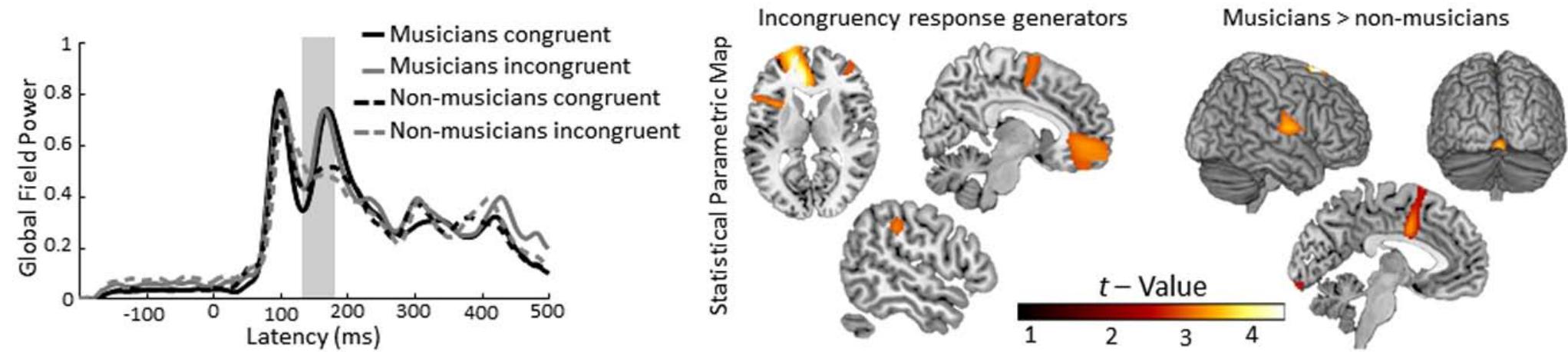 (PDF) Multisensory integration and neuroplasticity in the human ...