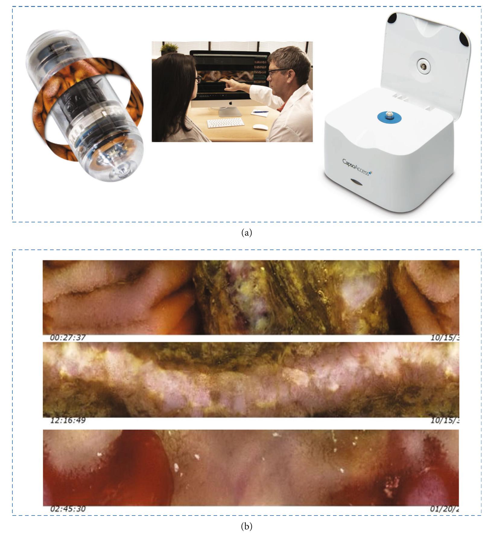 (PDF) Video Capsule Endoscopy and Ingestible Electronics: Emerging ...