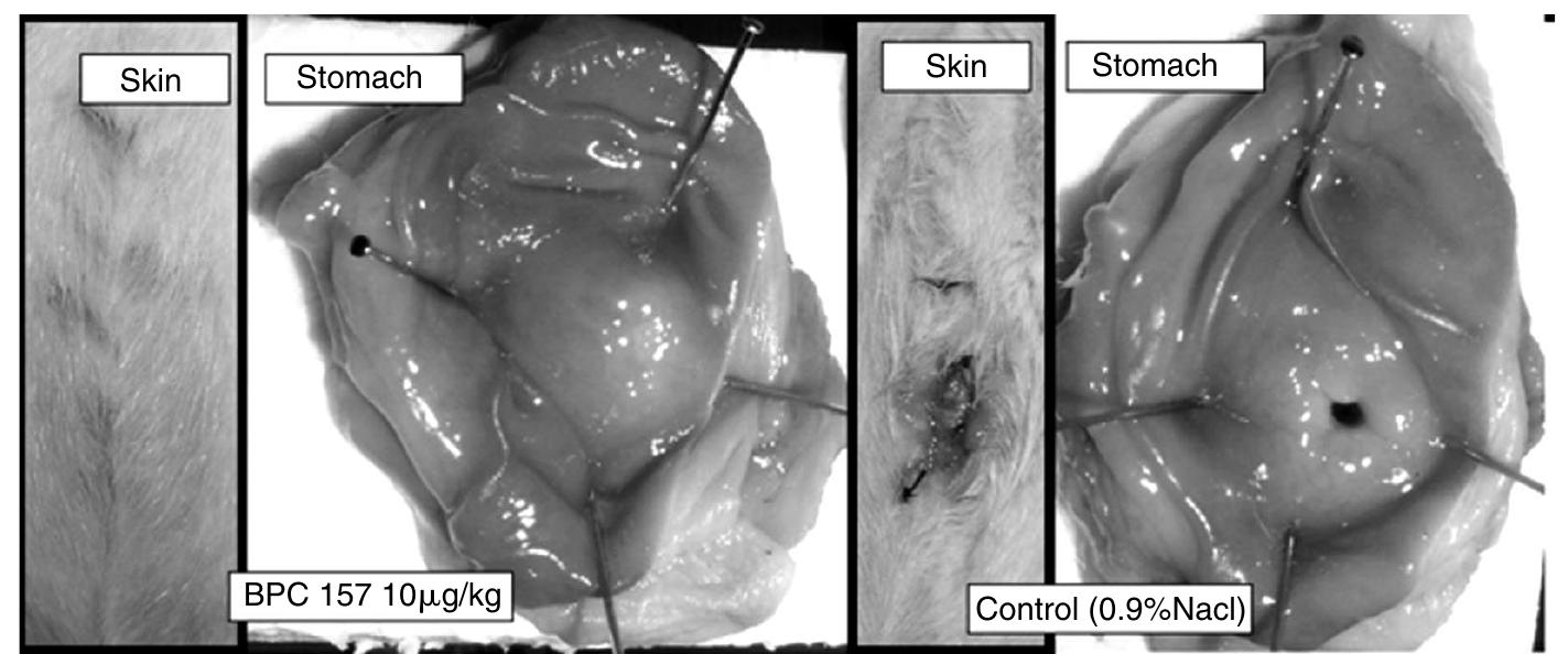 bpc 157 gastroparesis PDF) Prolonged esophagitis in rat: Stable gastric pentadecapeptide BPC 157 (PLD116, PL14736, Pliva) relation to critical period for threatening outcome and failure of lower esophageal and pyloric sphincter