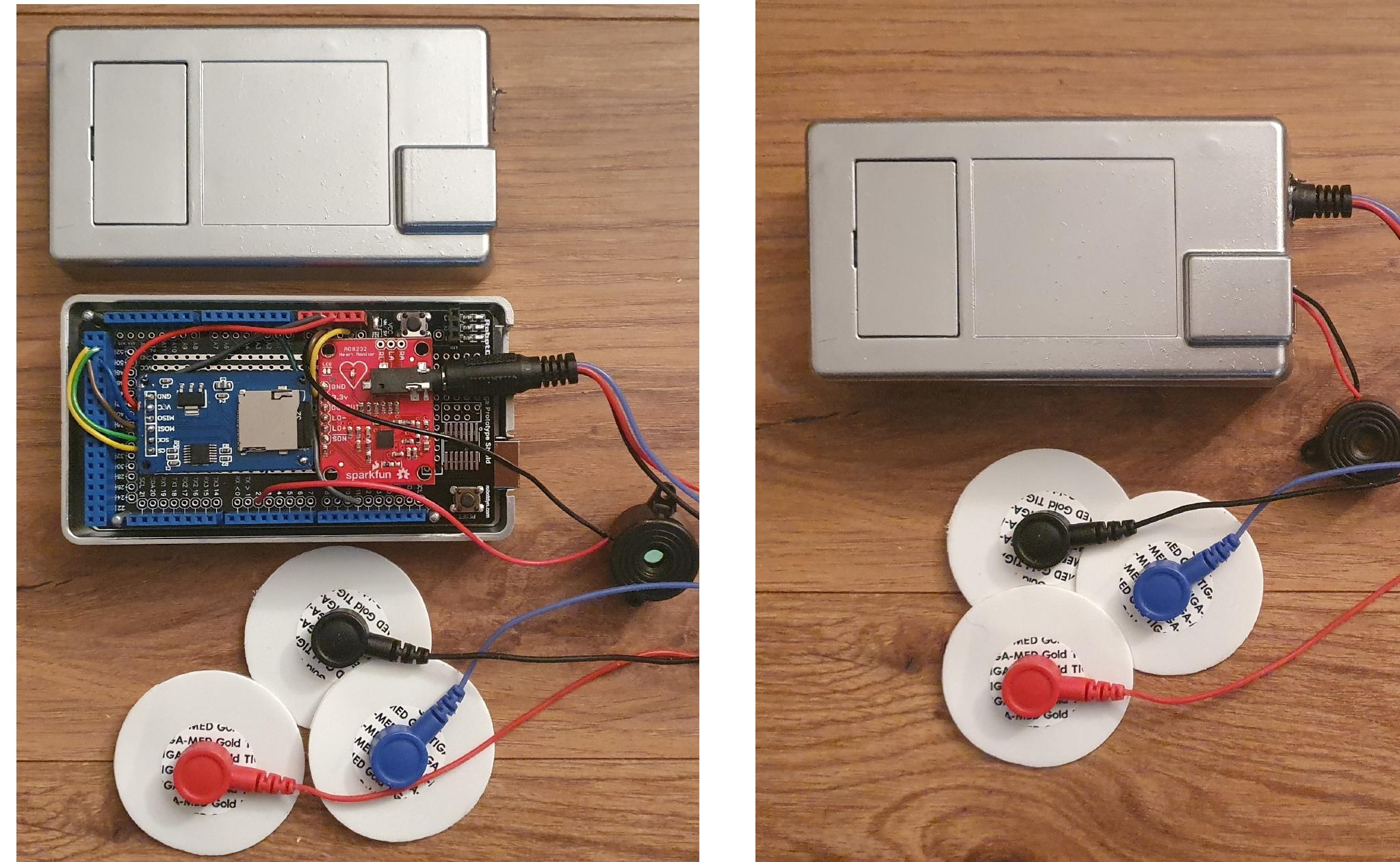Figure 2 - from An Arduino based heartbeat detection device