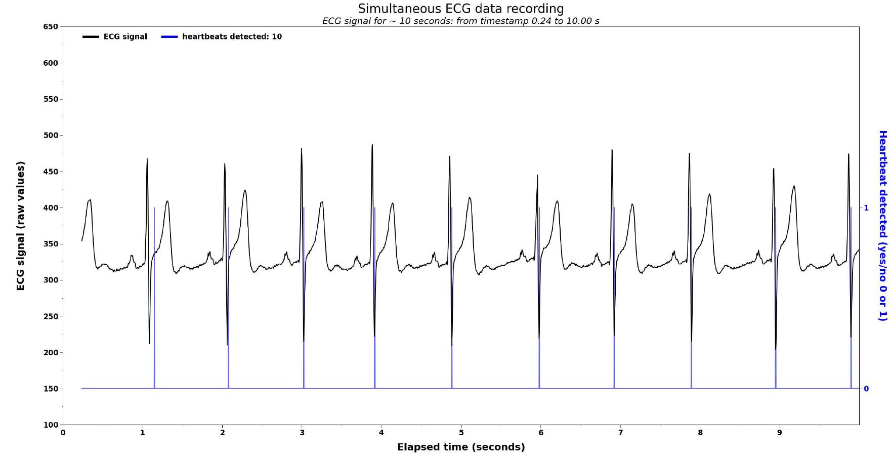 (PDF) An Arduino based heartbeat detection device (ArdMob-ECG) for real ...
