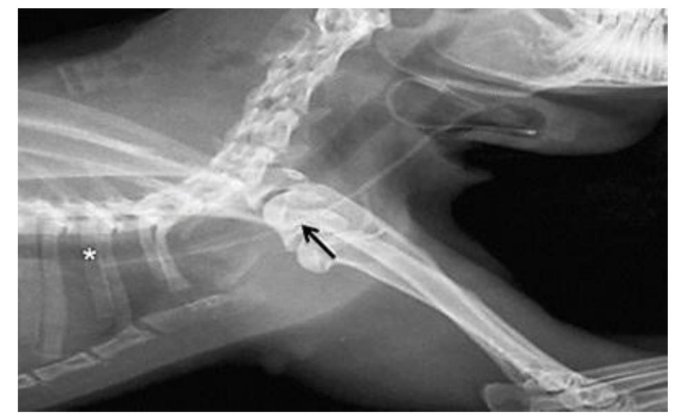 (PDF) Cholecystectomy during ceftriaxone therapy. A translational study ...