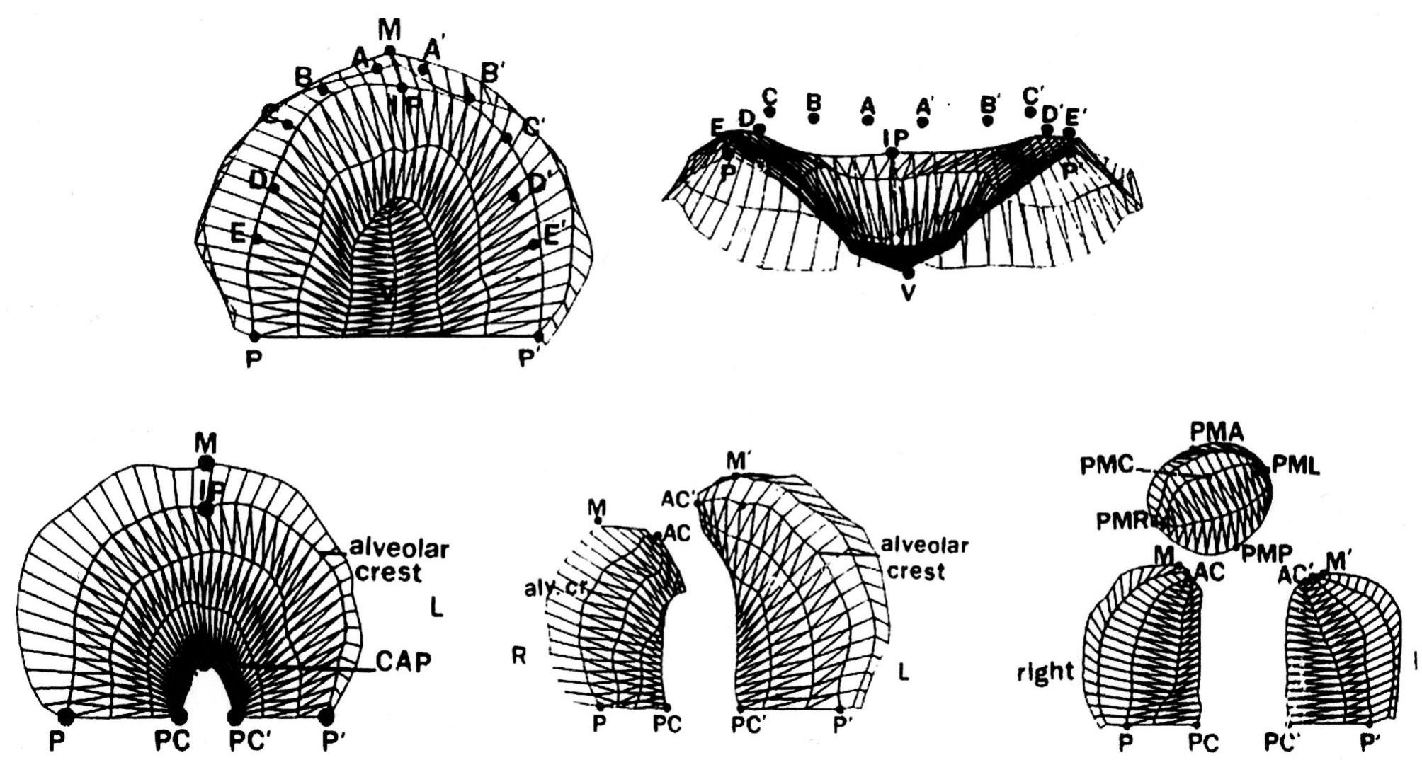 Various palatal forms being measured. (/100ve, left) inormal