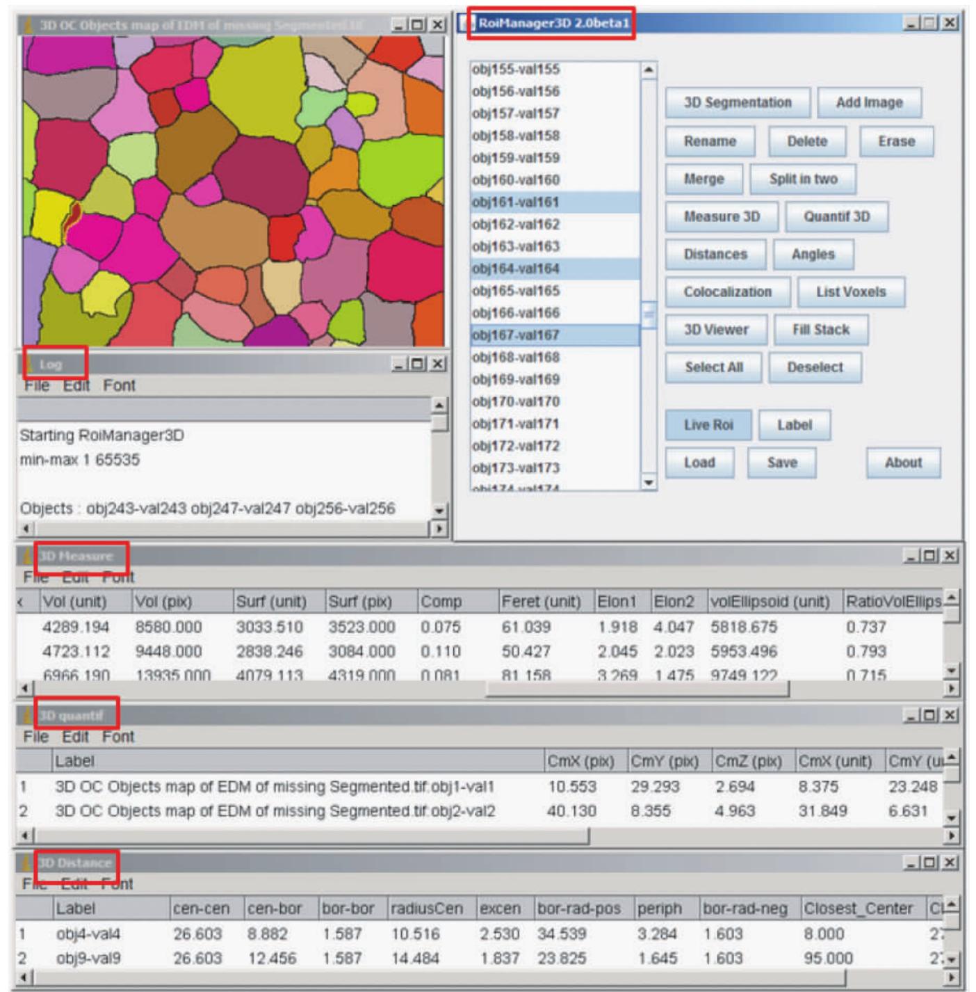 Microstructure Imagej Processing (PDF) A framework for image processing , analysis and visualization of ...