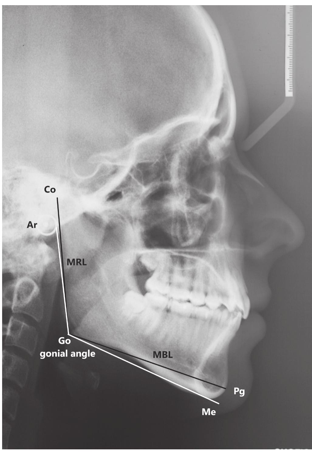 Figure 2 - from Age and gender estimation from mandible