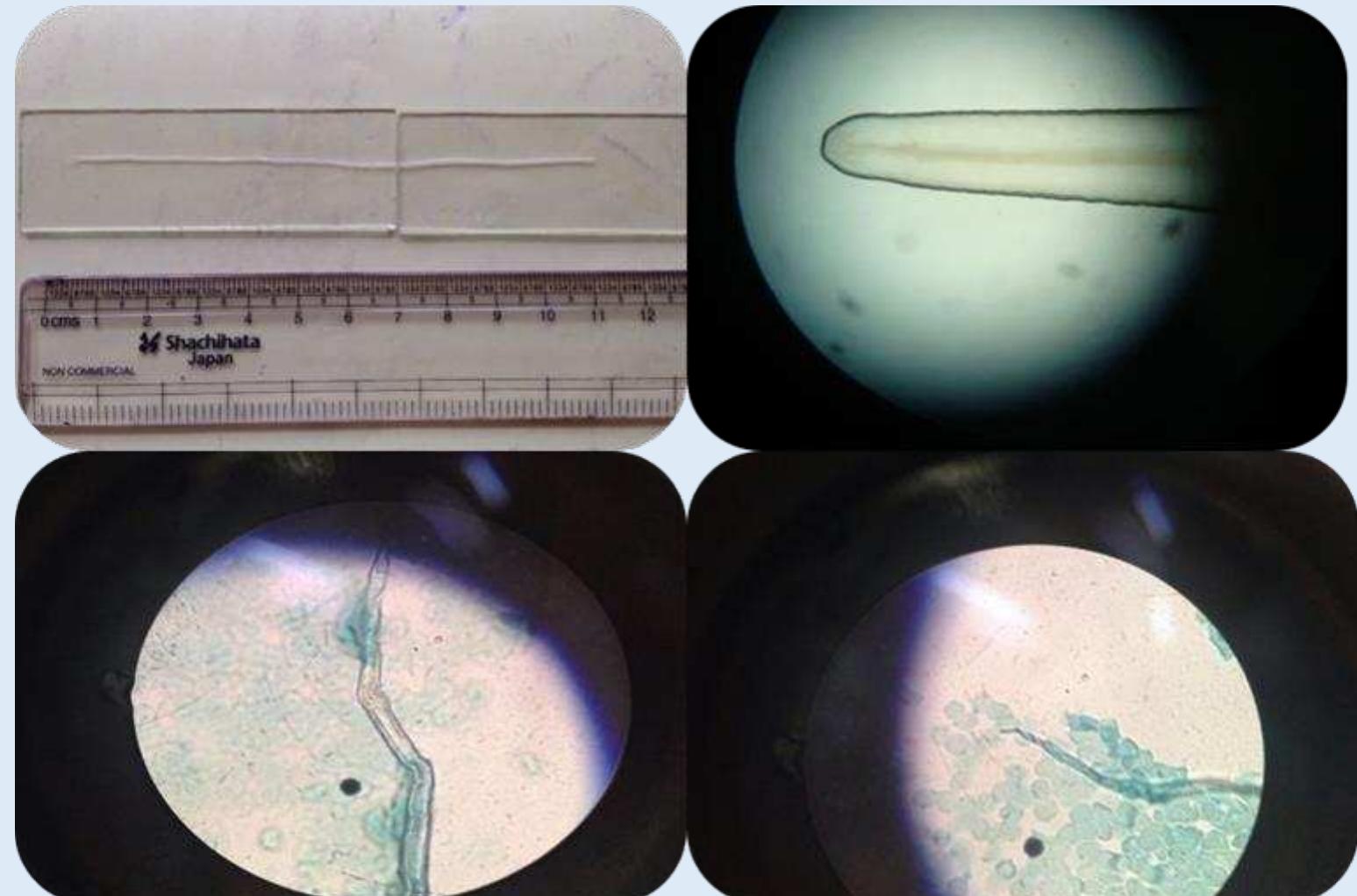 Life cycle of d. repens adapted from cdc website [36]. done