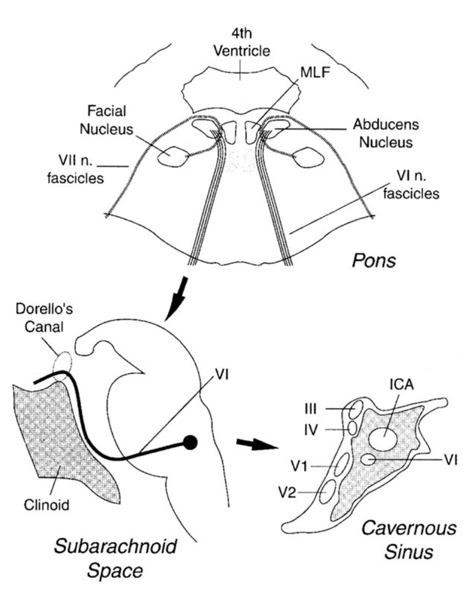 Anatomy of the abducens nerve. the speckled area demarcates