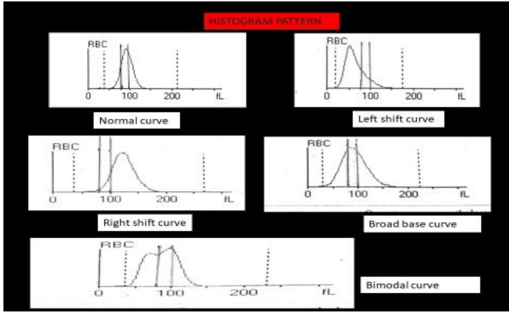 (PDF) Comparative Study of Peripheral Smear with RBC Indices and RBC ...