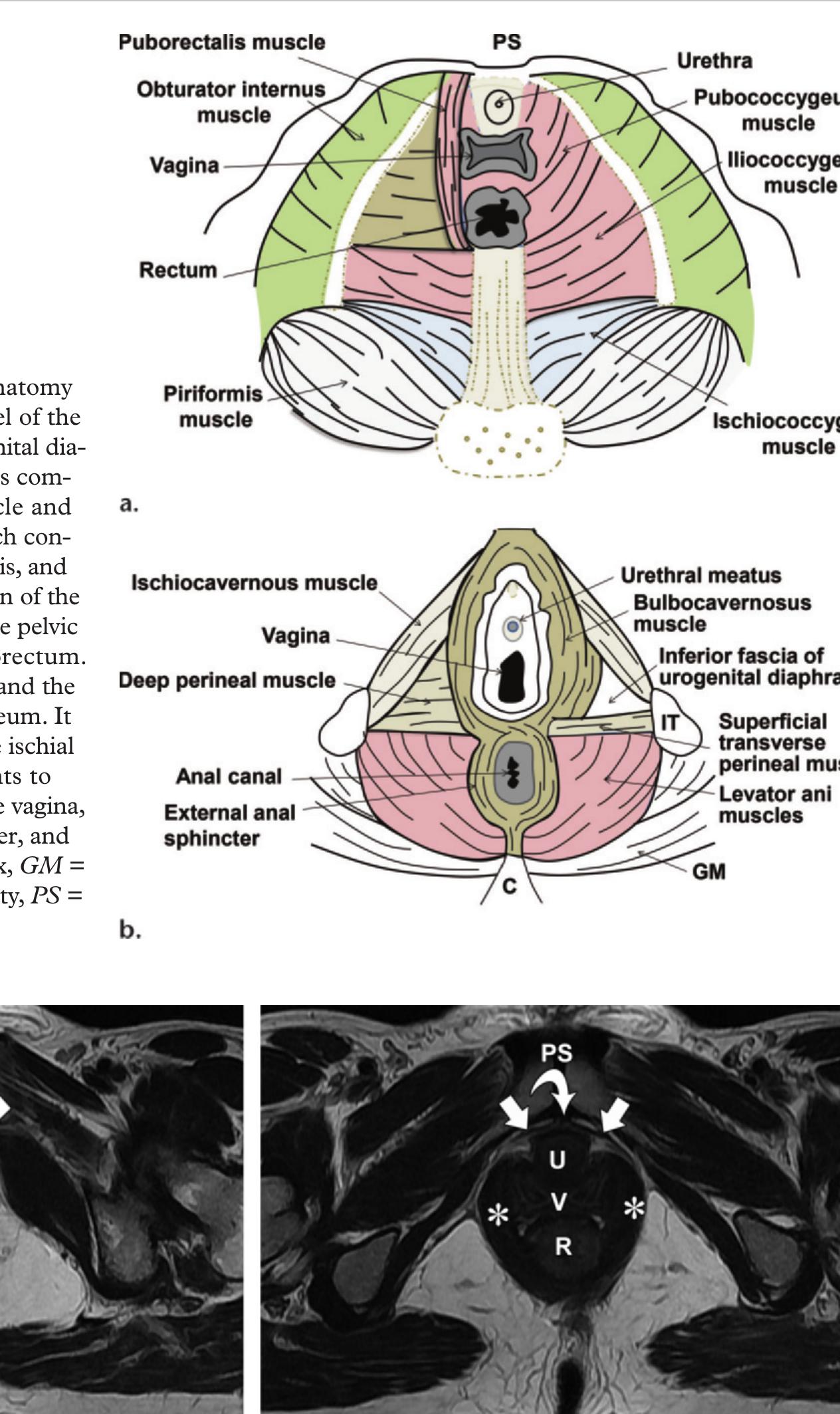 Figure 3 - MR Imaging–based Assessment of the Female Pelvic