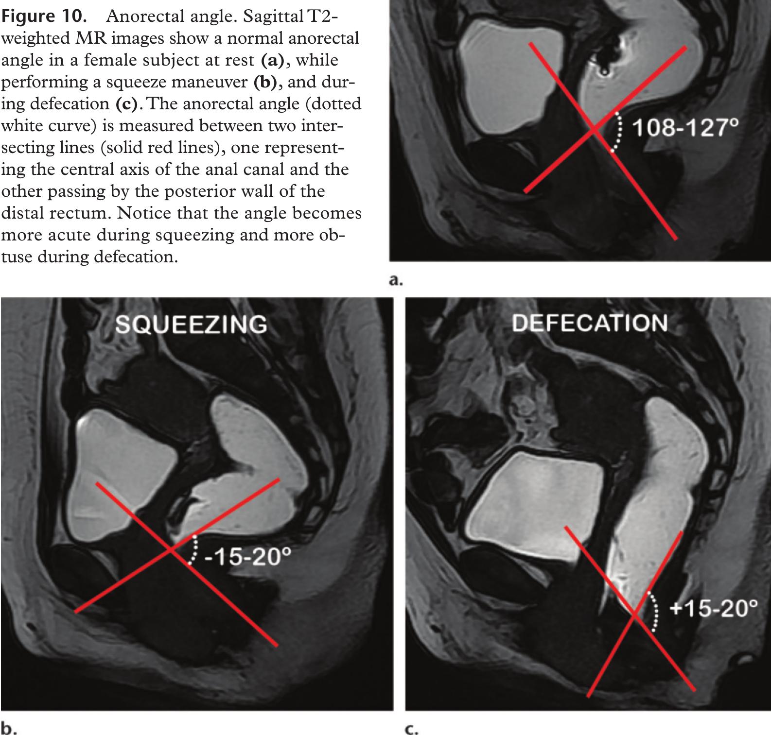 (PDF) MR Imaging–based Assessment of the Female Pelvic Floor