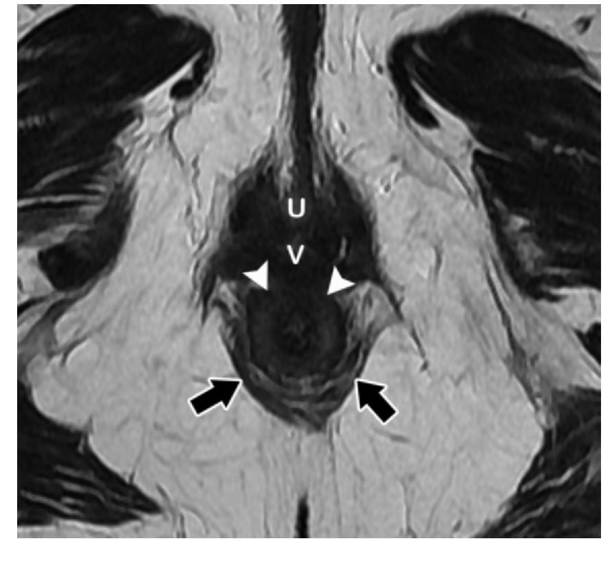 Figure 14 - MR Imaging–based Assessment of the Female Pelvic