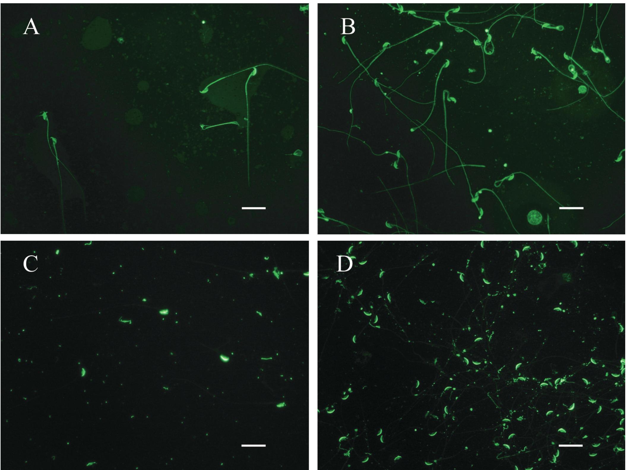 (PDF) Improved methodology for the detection and quantification of the ...