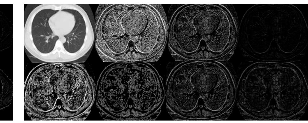 (PDF) COVID-19 Detection on Chest X-Ray and CT Scan Images Using Multi ...