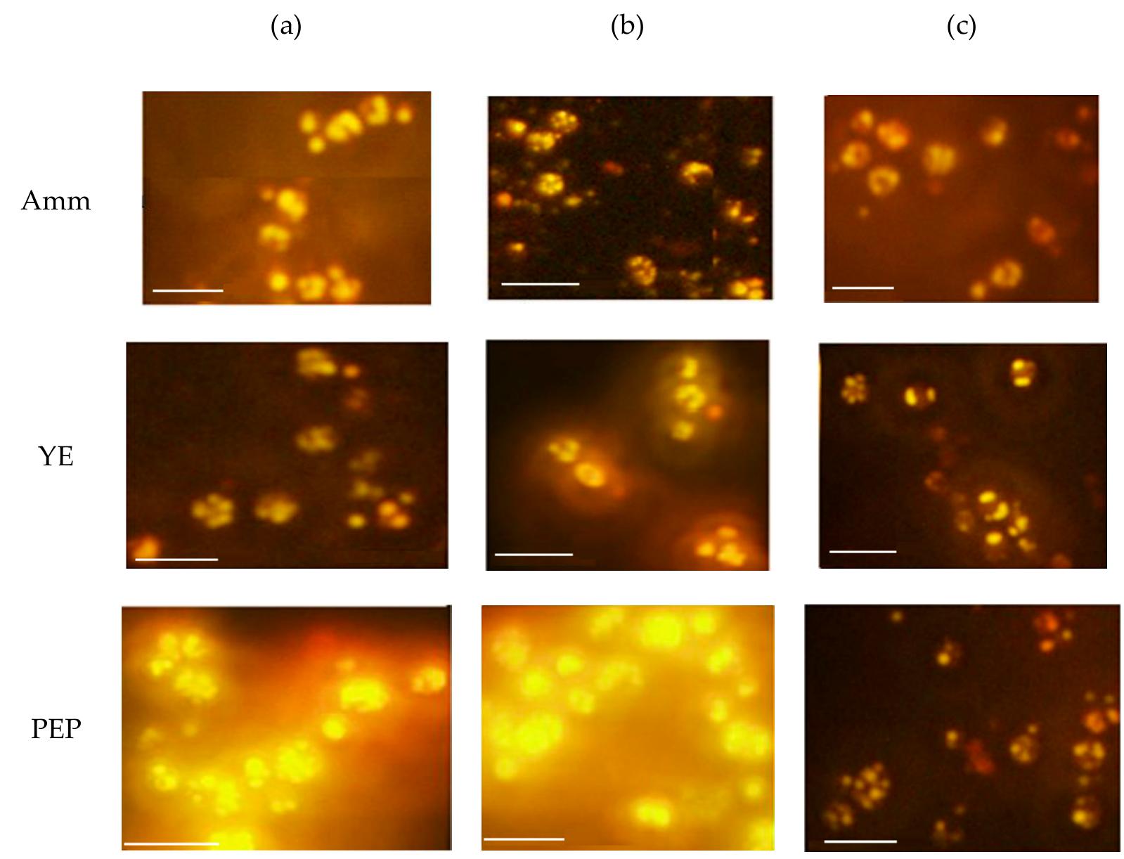 Microscopic examination of yeast cells stained with nile red