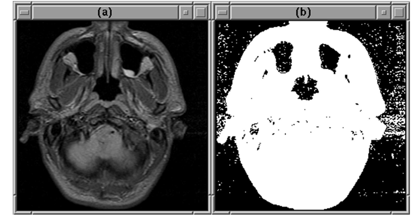 Original image and its threshold image image thresholding