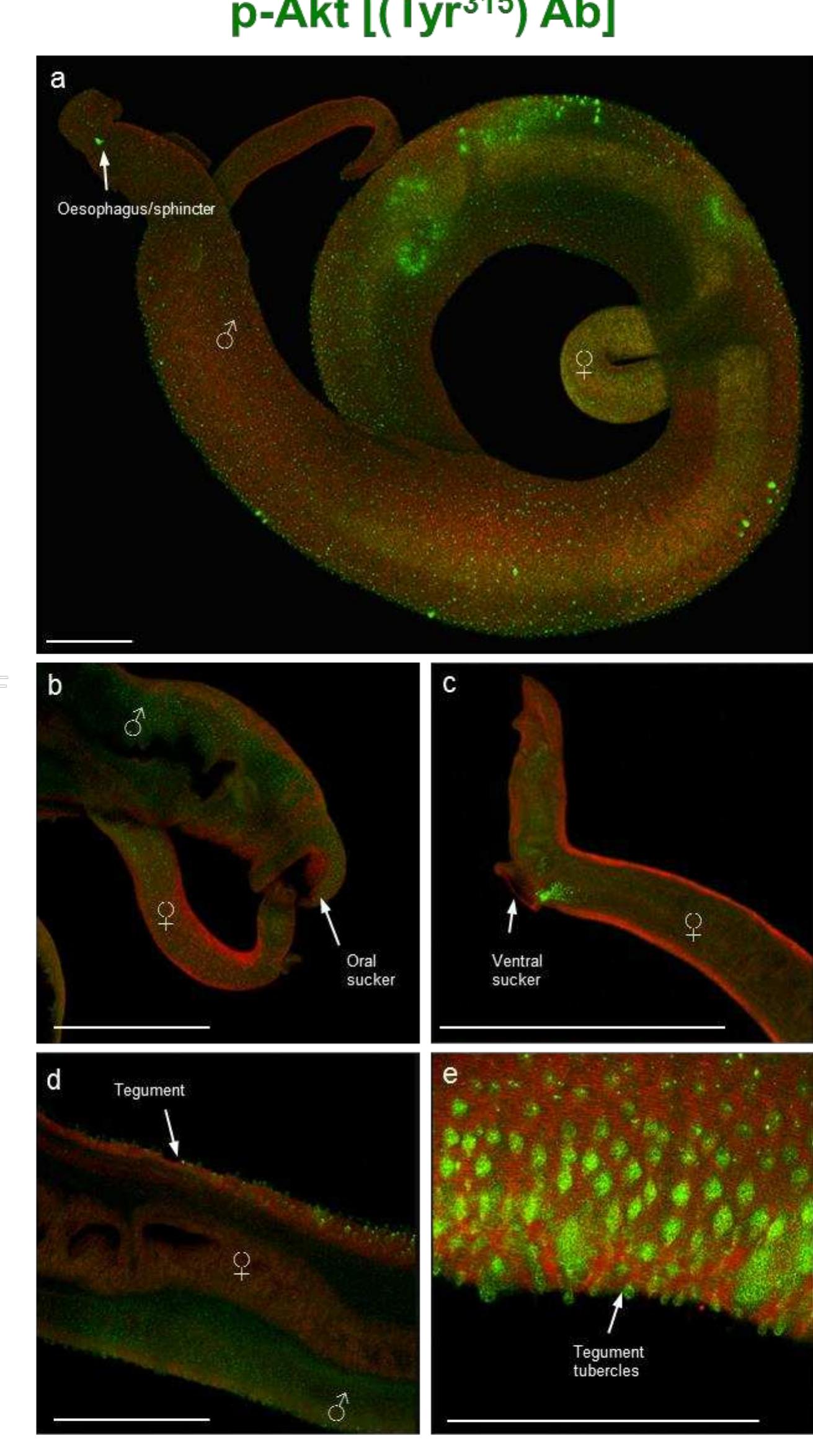 (PDF) Akt signalling in the human parasite 'Schistosoma mansoni