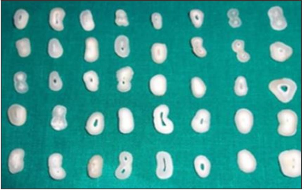 Horizontal Ground Sections Of Teeth horizontal-ground-sections-of-teeth