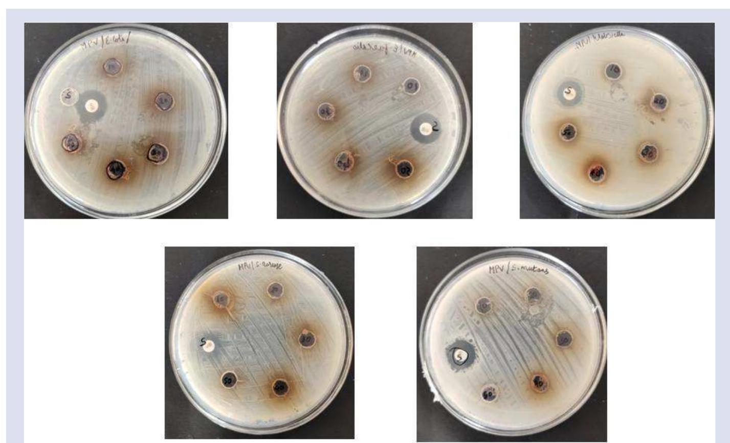 (PDF) Screening of Phytochemical Analysis and In vitro Bioactive of ...
