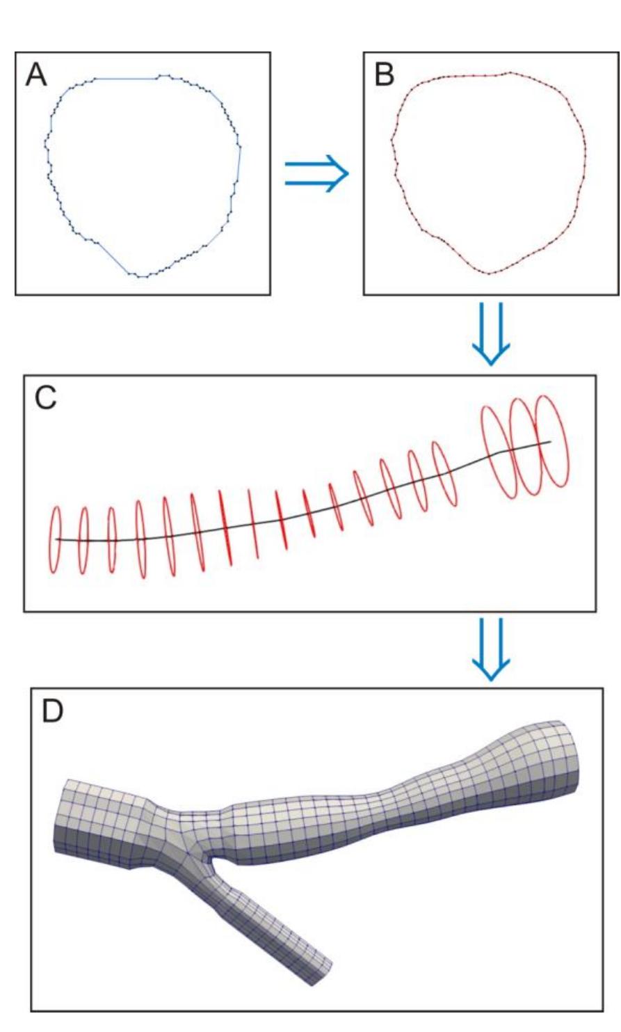 (PDF) 3D Reconstruction of Patient-Specific Carotid Artery Geometry ...