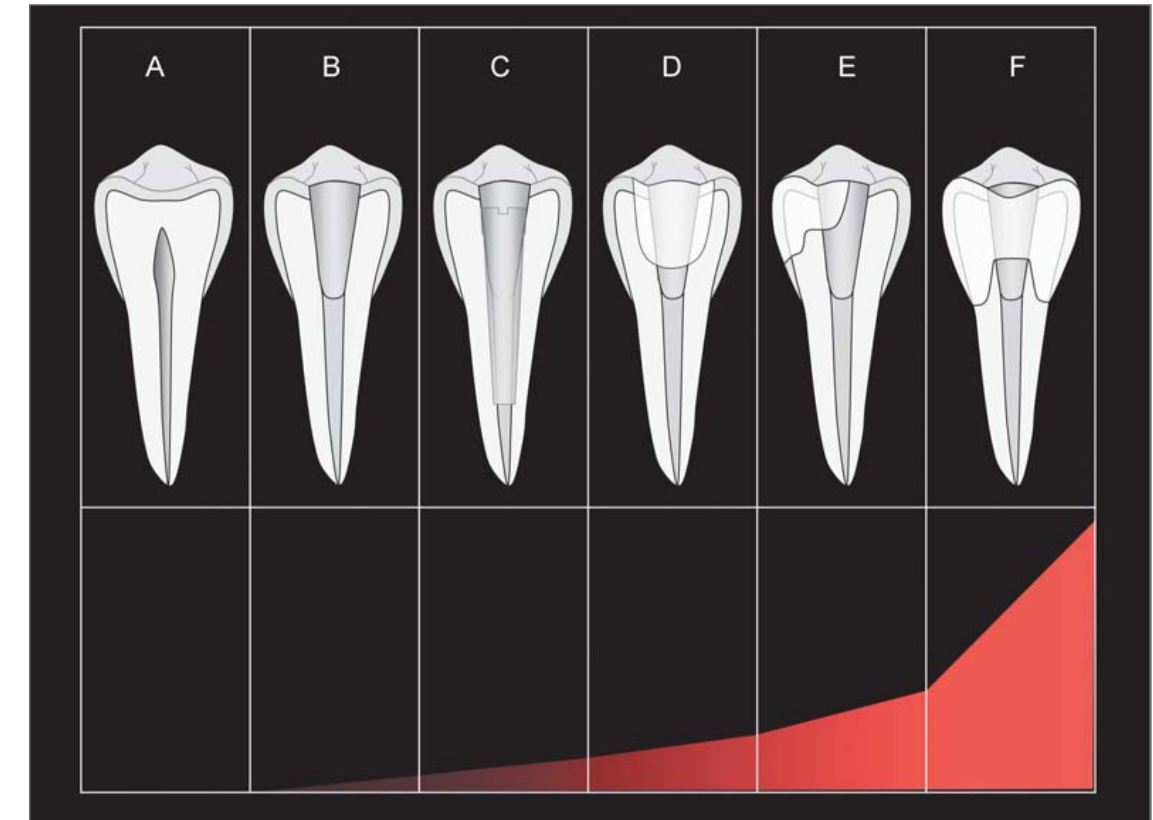 (PDF) Biomechanical considerations for the restoration of ...