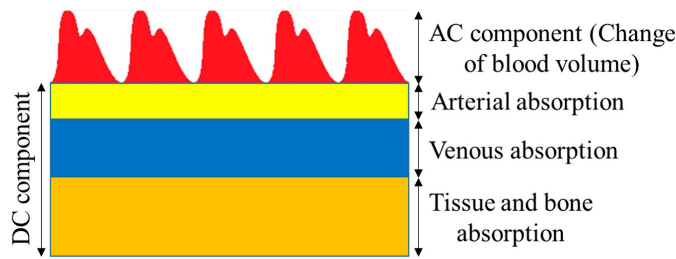 A ppg signal consists of ac and dc components. the ac