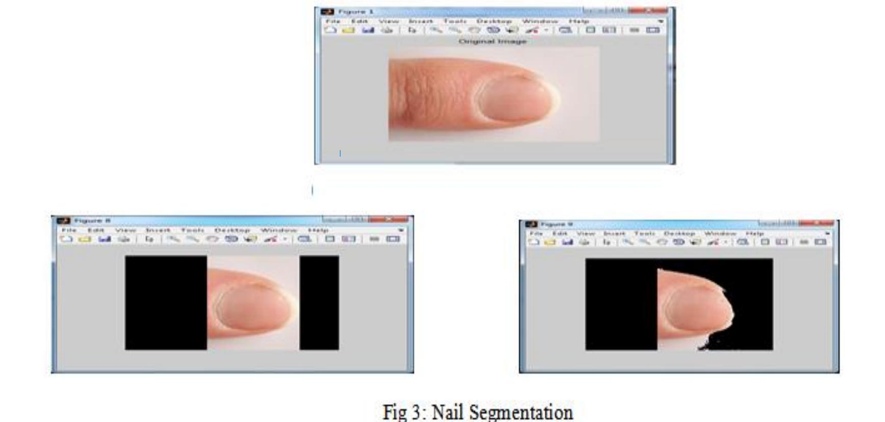 3.2 methodology of the proposed system (i) scanning back
