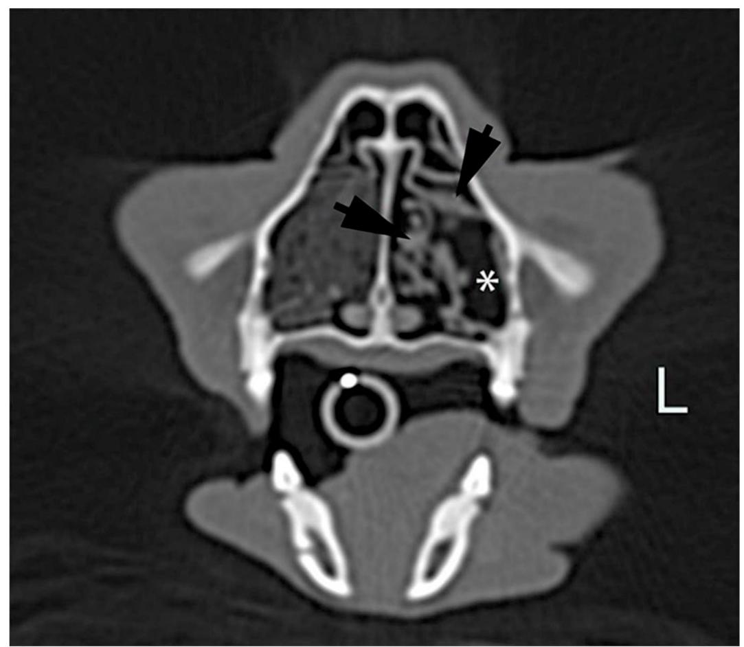 Figure 1 - from CT review of upper respiratory disorders in