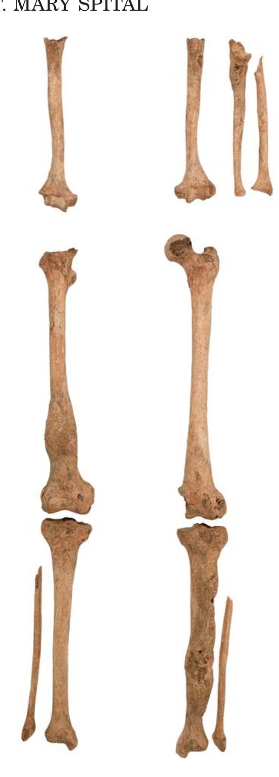 Rörben Figure 1 - from Evidence of skeletal treponematosis from the