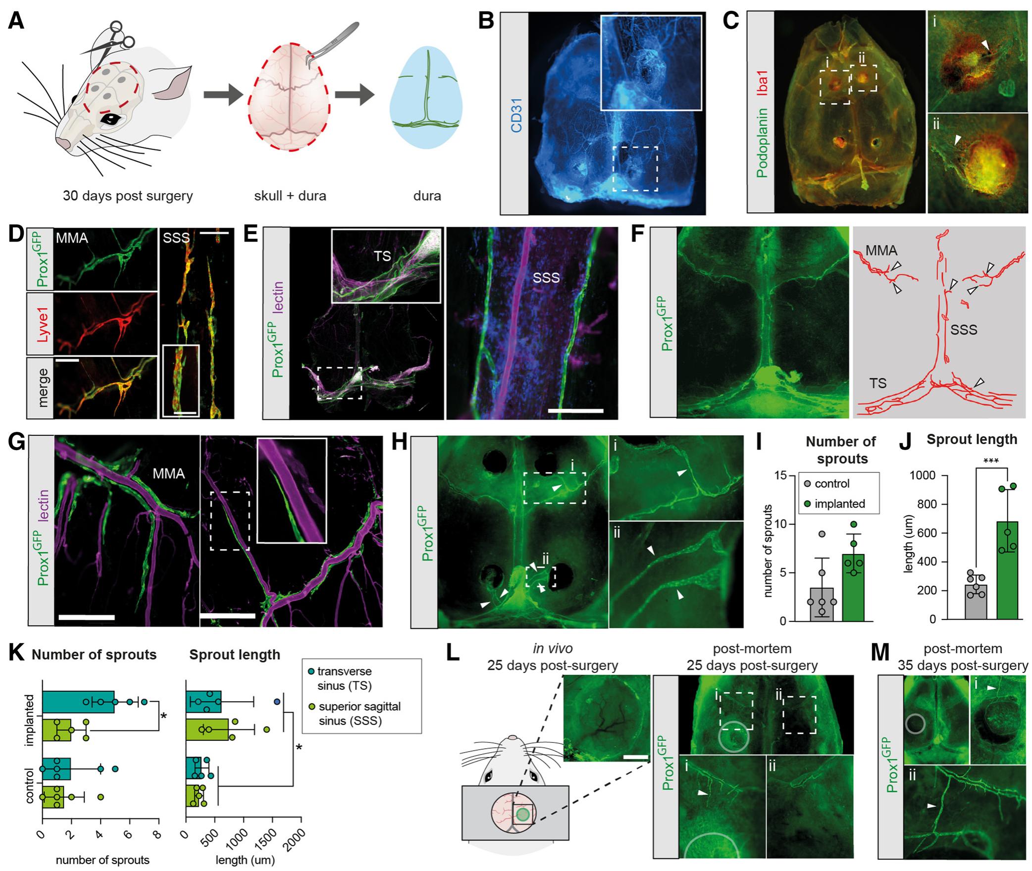 Electrode implantation induces meningeal lymphatic