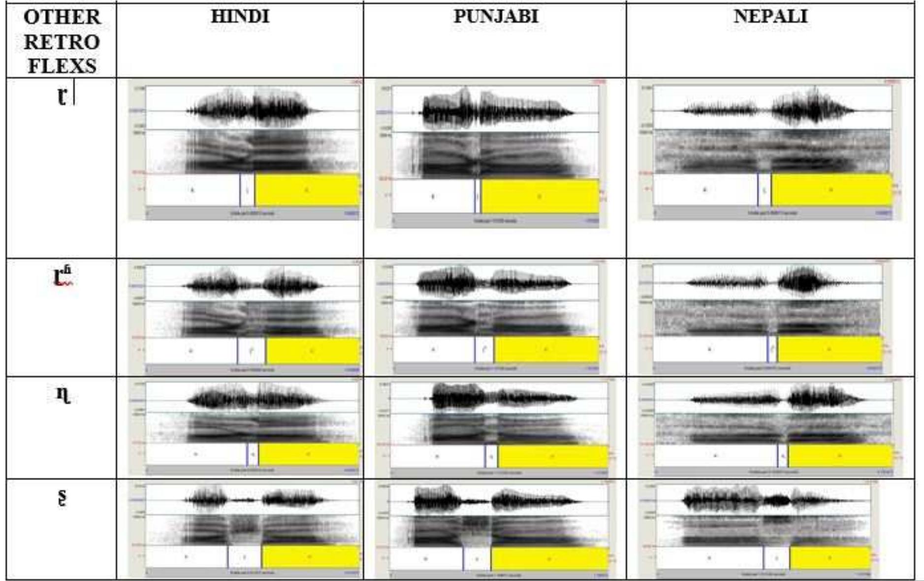 - spectrogram of other retroflex consonants t/ and /t*/