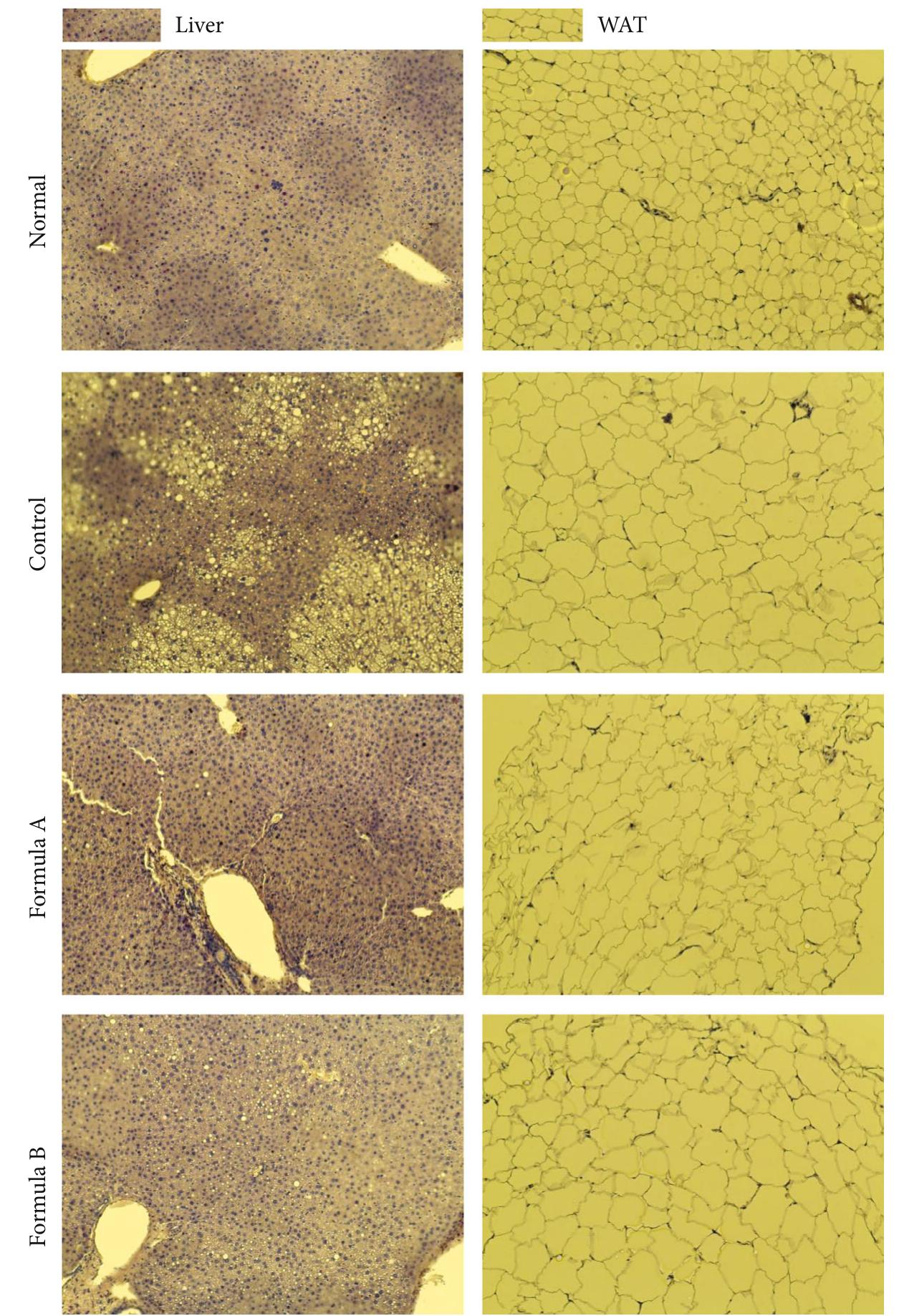 Histological observation of liver tissue and white adipose