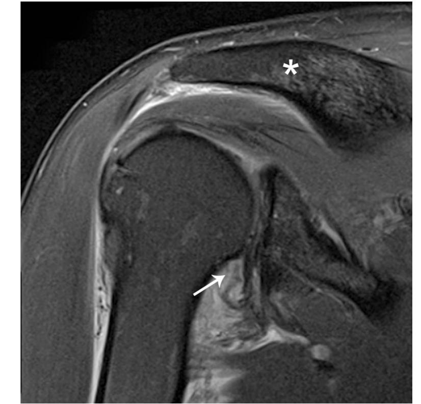 A 61-year-old man with shoulder pain status post fall 3 days