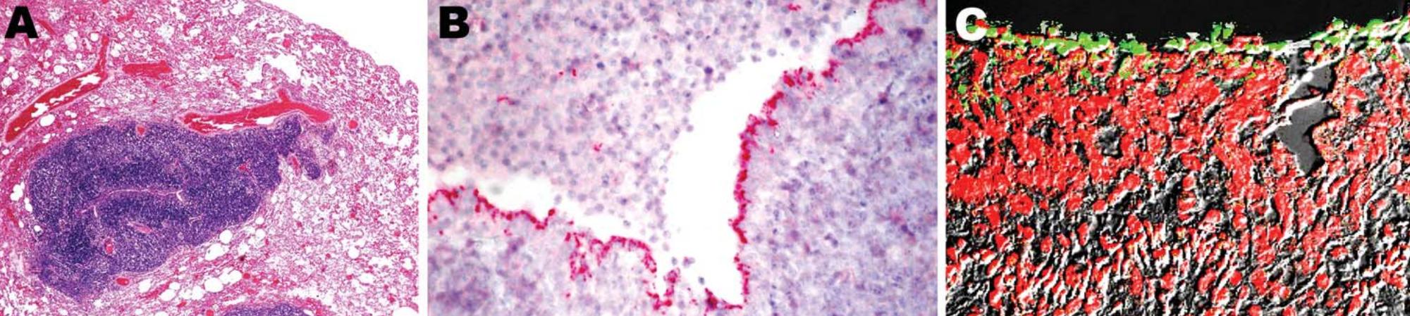 Feret Microscope Micrographs of a section of lung from a 2-year-old ferret