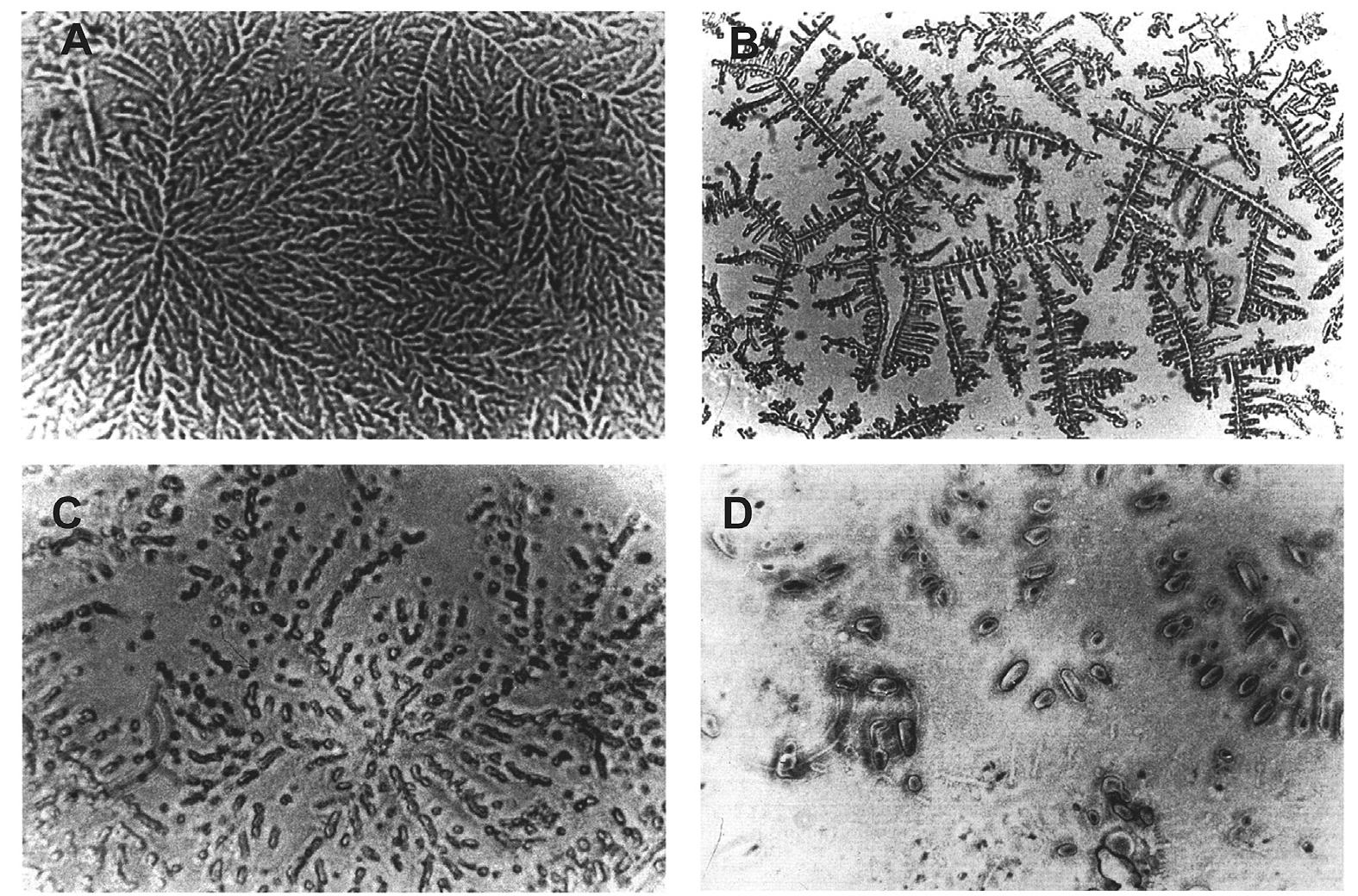 Examples of tear ferning patterns for rolando's grade 1 (a),