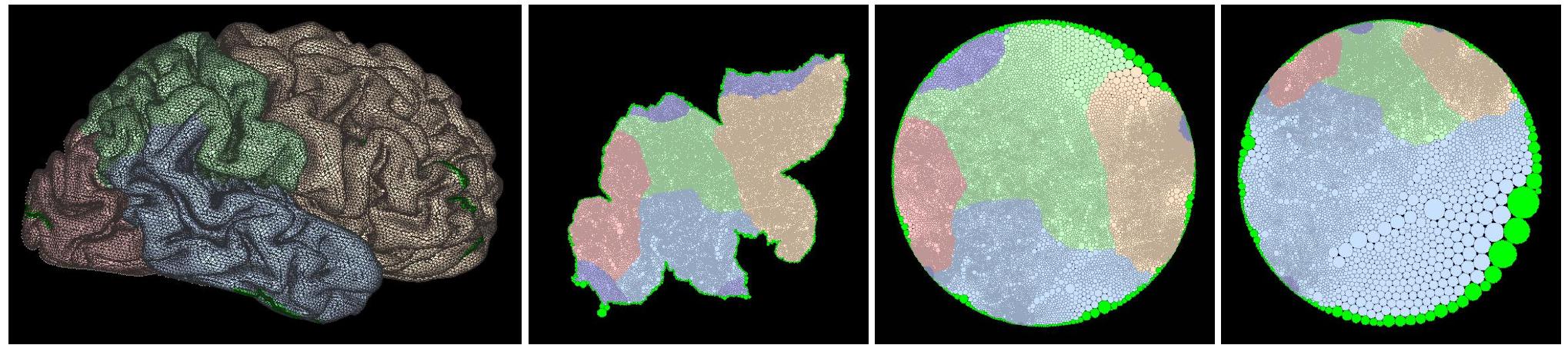 (PDF) Case study: interacting with cortical flat maps of the human brain