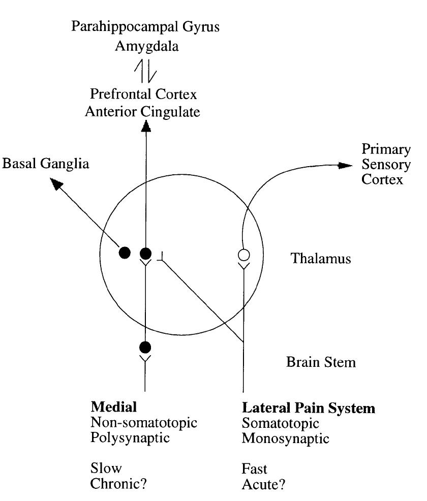 A schematic representation of the medial and lateral pain