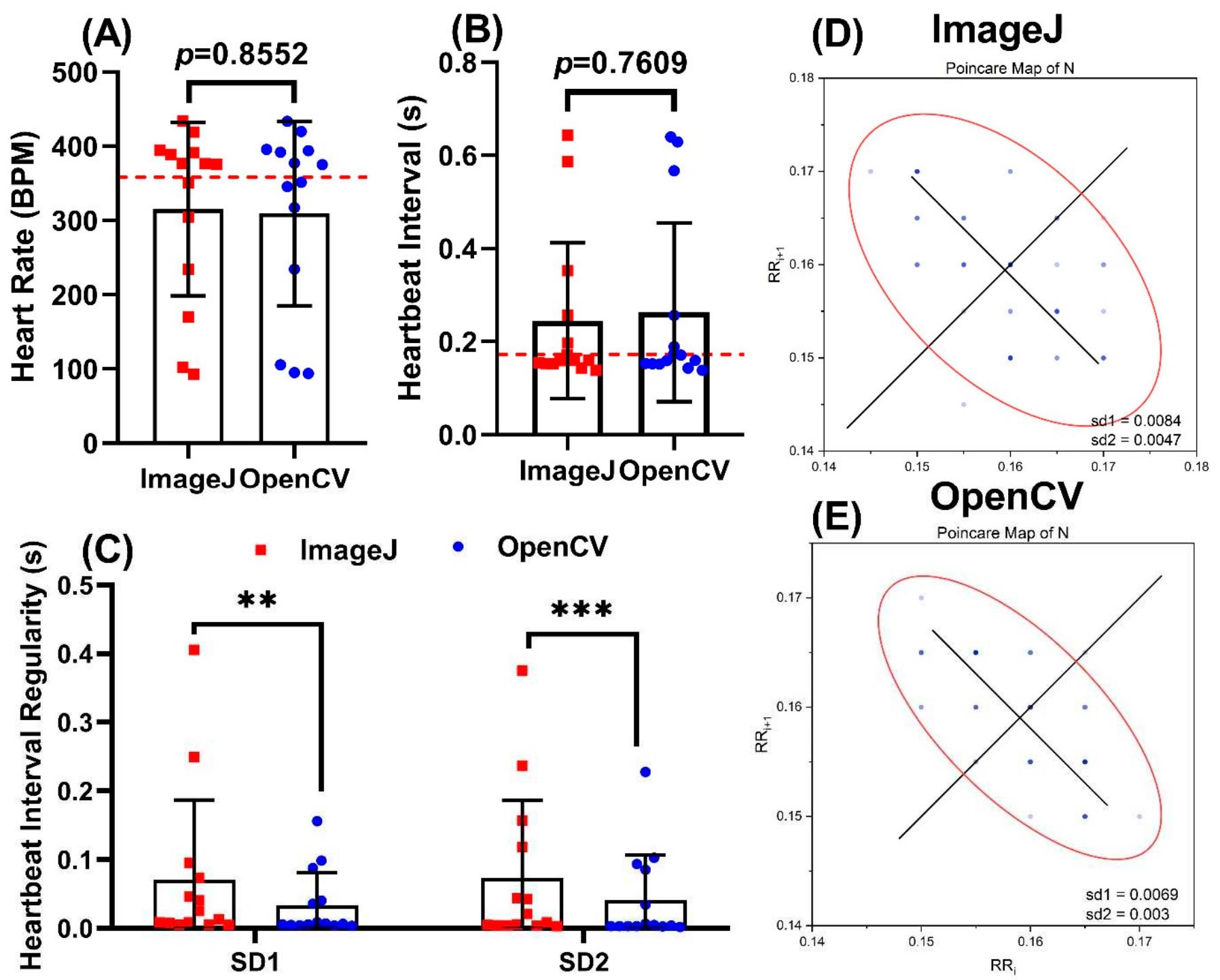 Opencv Normalization Comparison of atrium-ventricle (a) and ventricle-atrium (b)