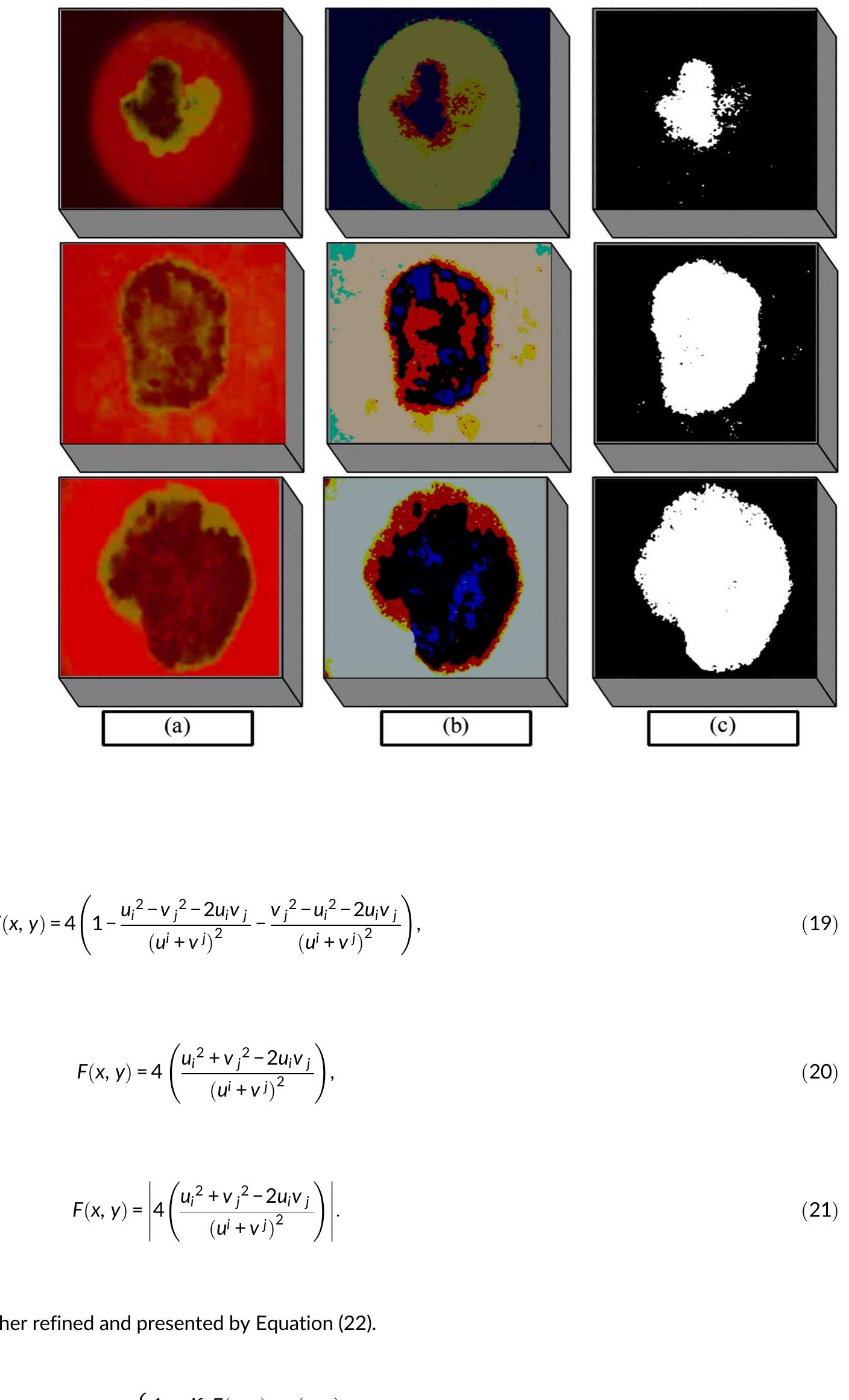 (PDF) Skin lesion segmentation and classification: A unified framework ...