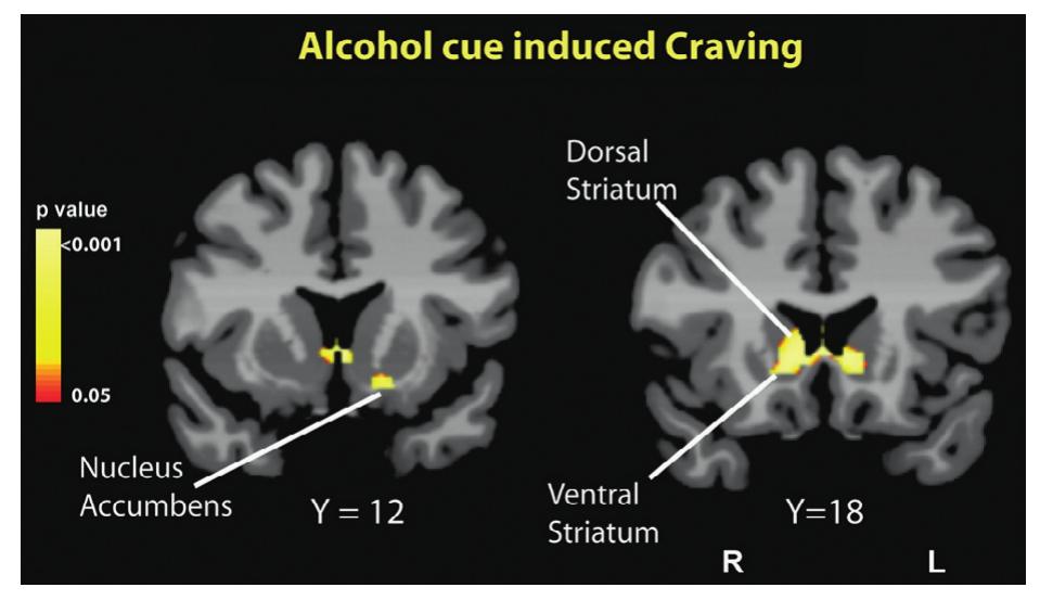 (PDF) The neurobiology of alcohol craving and relapse